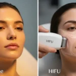Thermage vs HIFU – Which Skin Tightening Treatment is Right for You?